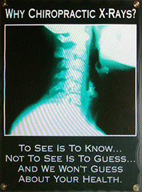 Ｘ線（レントゲン）について